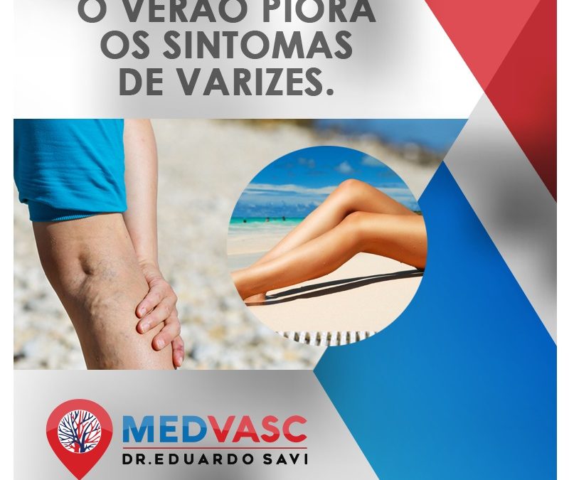 Estética vascular para o verão.